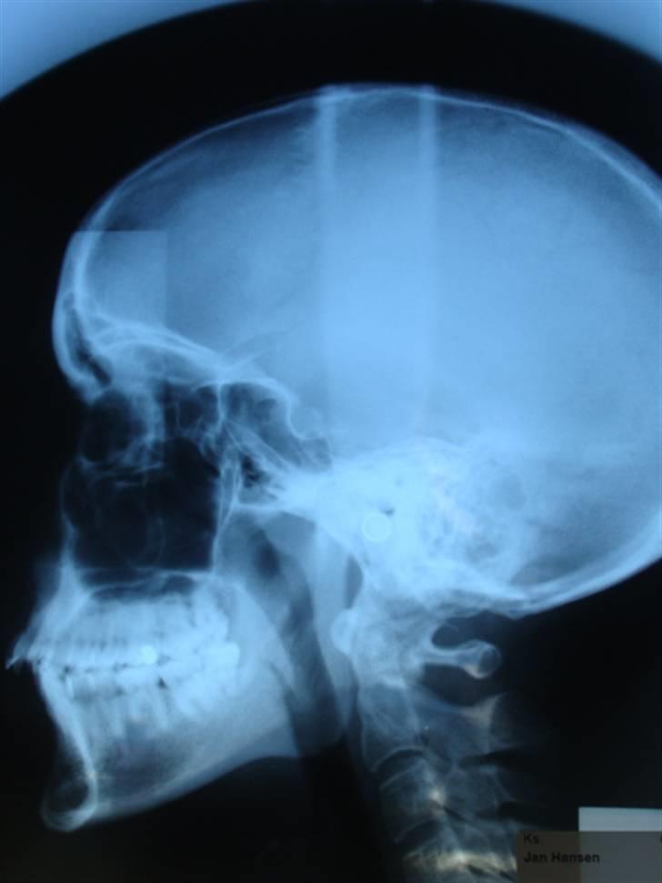 Subaru Forester XT (STI) - Jeg v ik hvorfor d her sku på  jeg synes d var flot d r a en a mine venner der ska ha rettet tænder billede 15