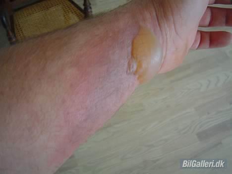 Renault laguna RT  - det er hvad der sker når man åbner for en køler der koger billede 5