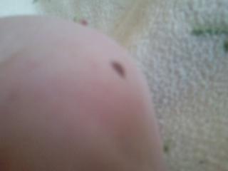 Marsvin - Pinkie with the Redhead (Skinny) - Pinkie's ene plet (-: billede 10