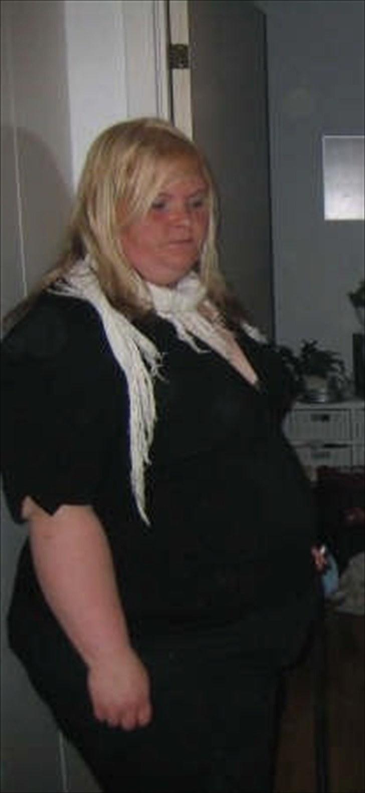 NYE FØR/EFTER BILLEDER AF MIT VÆGTTAB.. ;)  - Ja billede taler for sig selv... 2008.. og en vægt på ikke mindre end 169.9 kilo.. billede 1