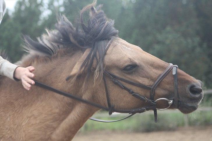 Cushing syndrom billede 1