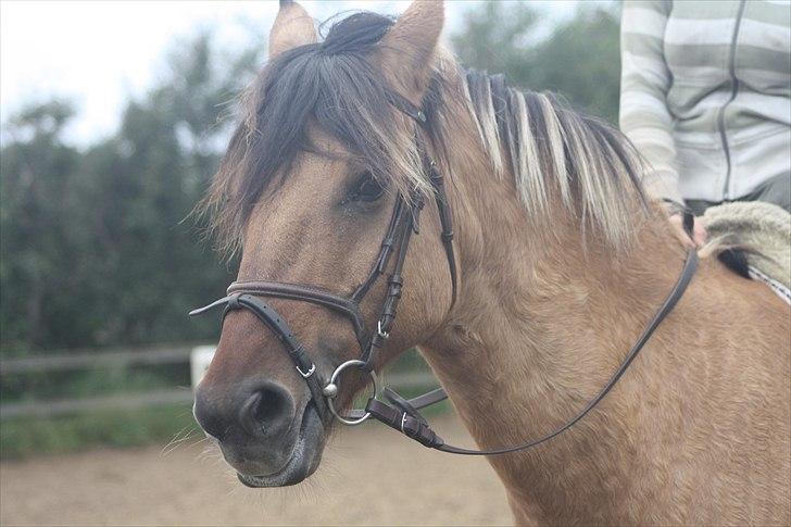 Cushing syndrom billede 4