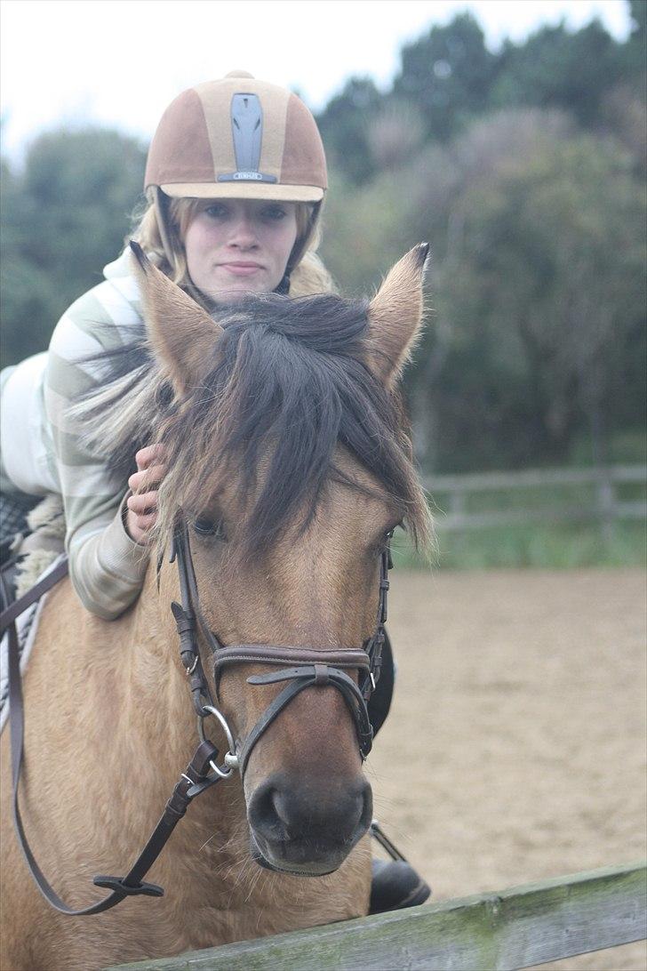 Cushing syndrom billede 5