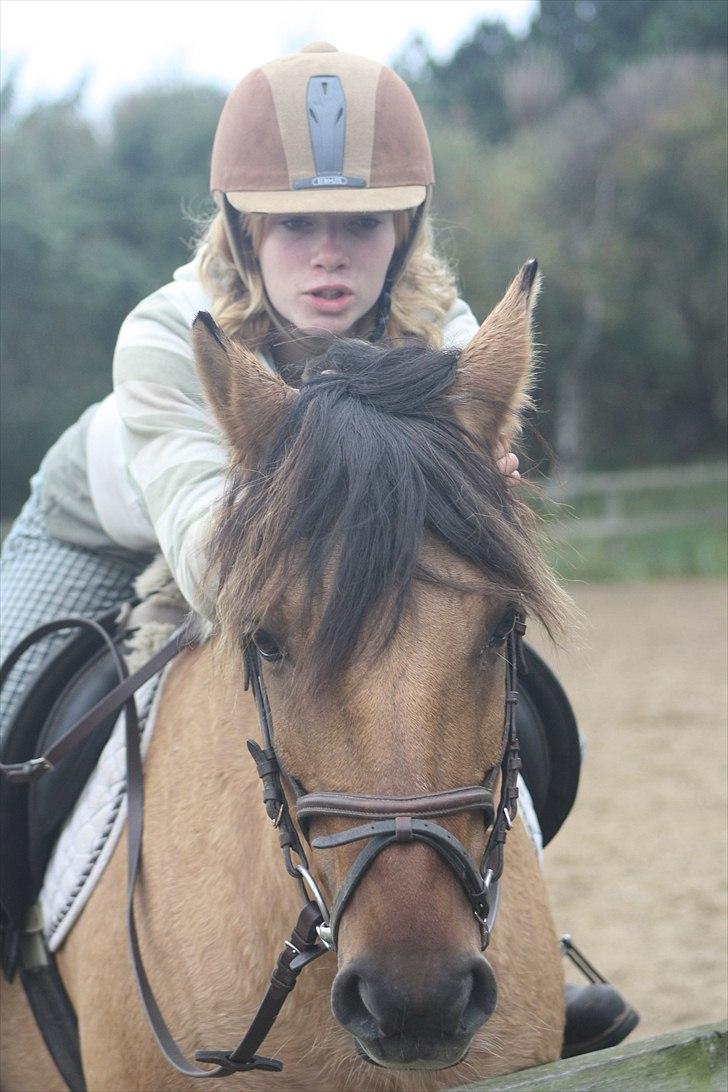 Cushing syndrom billede 6