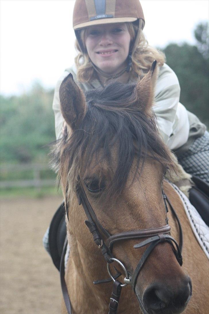 Cushing syndrom billede 7