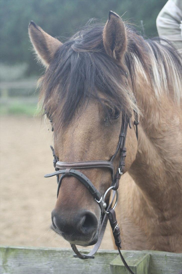 Cushing syndrom billede 8