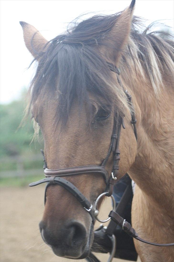 Cushing syndrom billede 9