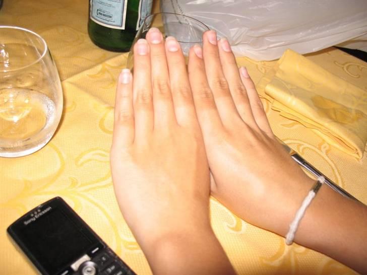 På cykel til Italtien, 2007 - Mærker efter cykelhansker. billede 43