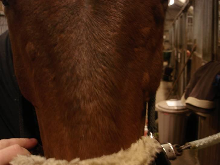 Rikke havede nældefeber 28/3-08 - Små hævelser i hovedet billede 2