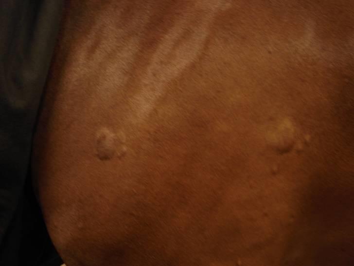 Rikke havede nældefeber 28/3-08 - Hævelser på kroppen billede 3