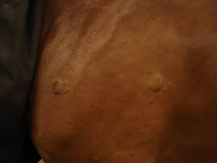 Rikke havede nældefeber 28/3-08 - Hævelser på kroppen billede 4