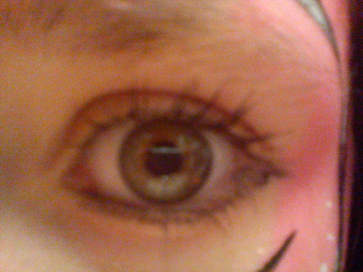 Min malign i hovedt efter fest billede 21