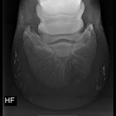 Silvas hov operation (keratom) - Røtgenbillede af keratomet (hornsøjlen) billede 1