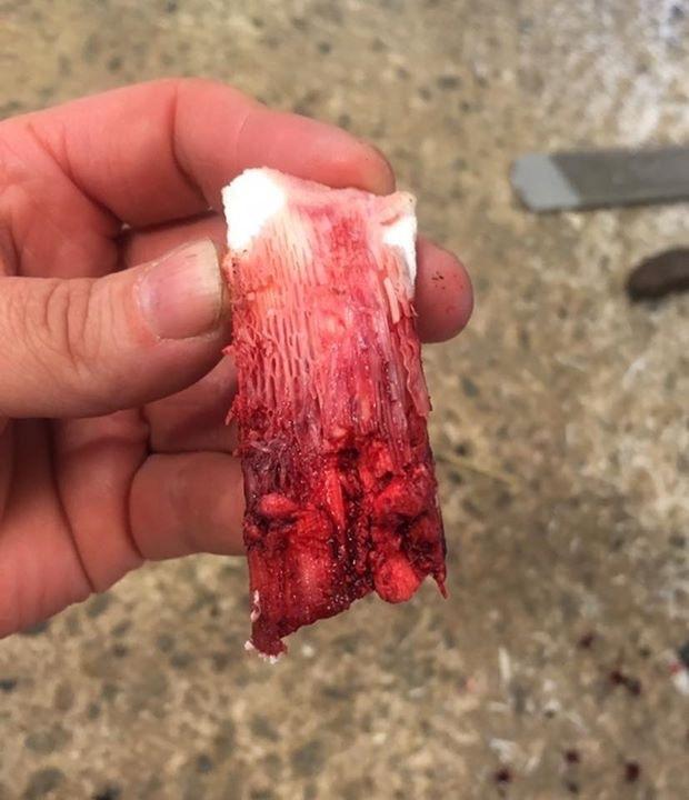 Silvas hov operation (keratom) - Her er synderen! billede 9