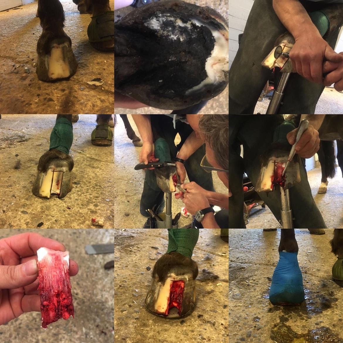 Silvas hov operation (keratom) billede 13