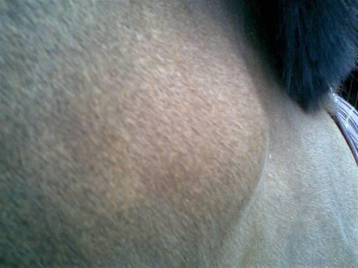 Byld efter vaccine billede 1