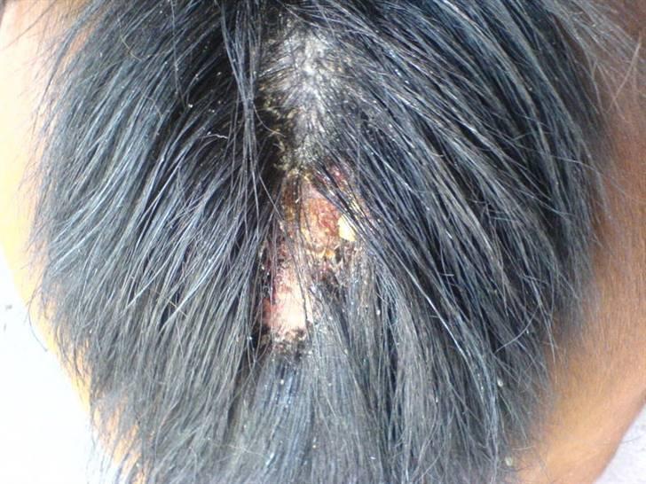 Til skræk og advarsel.. aldrig haleforbinding - Hudinfektion efter haleforbinding i forbindelse med bedækning billede 1