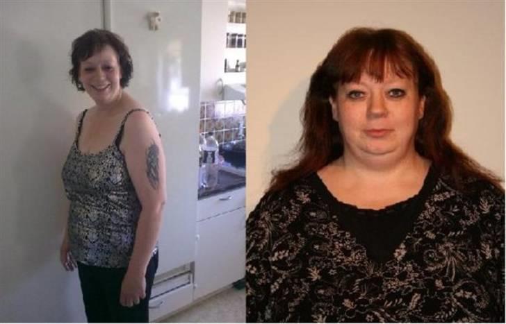 Før og efter (vægttab) - 75 kg billede 6