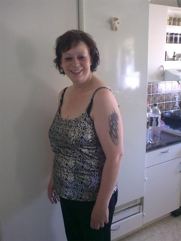 Før og efter (vægttab) - 75 kg billede 8