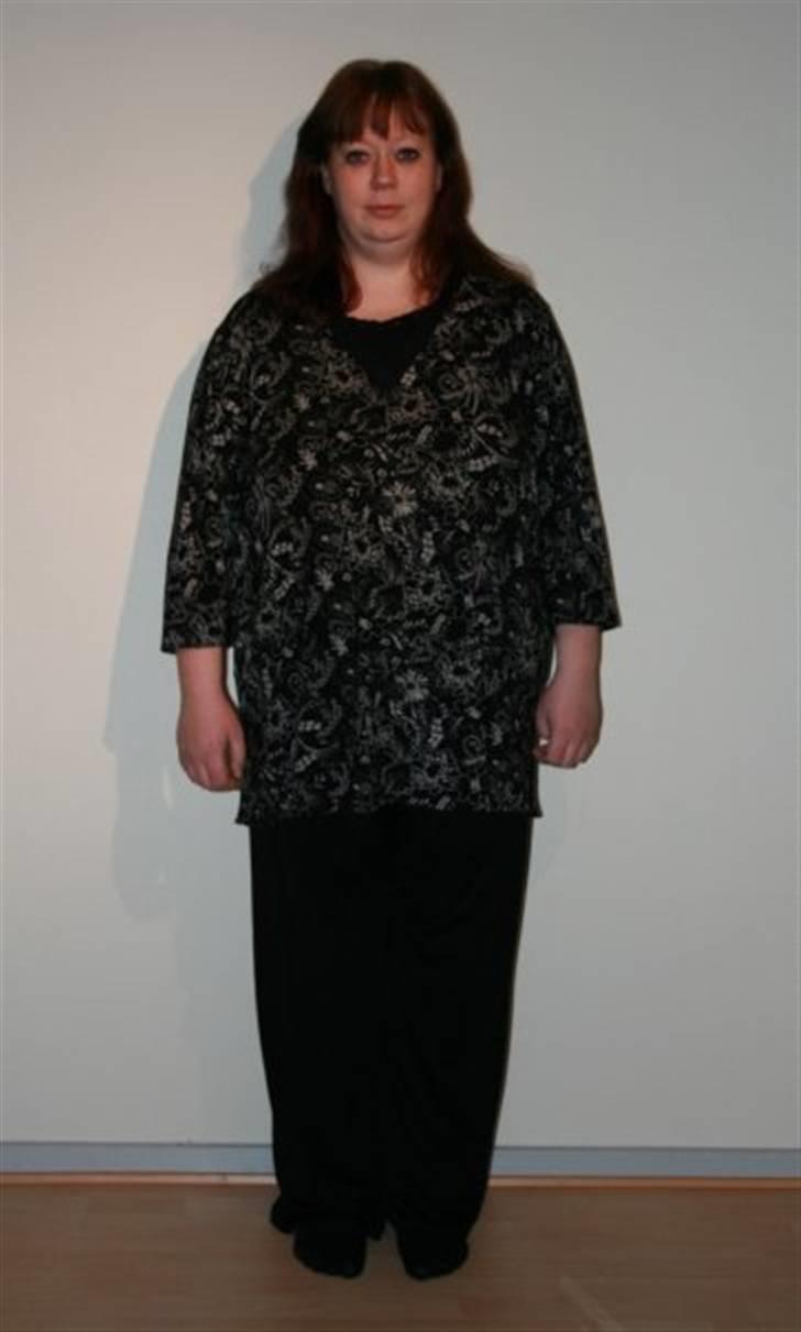 Før og efter (vægttab) - 75 kg billede 10