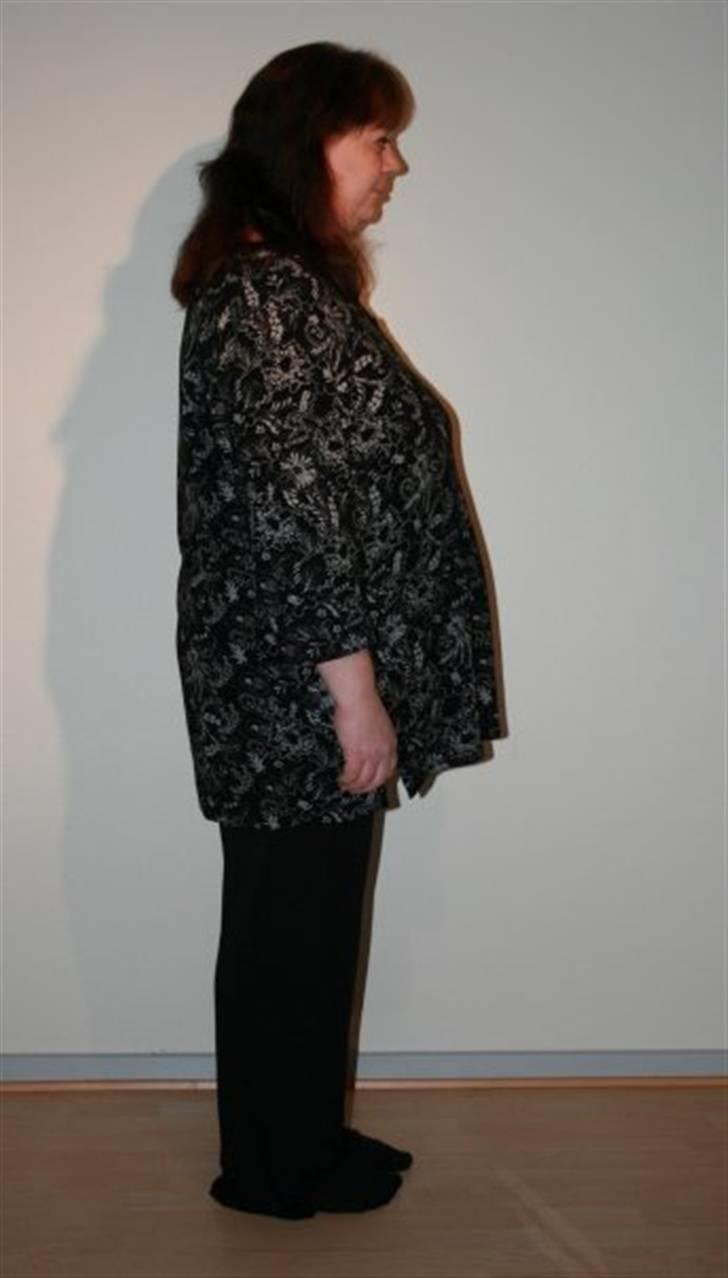 Før og efter (vægttab) - 75 kg billede 11