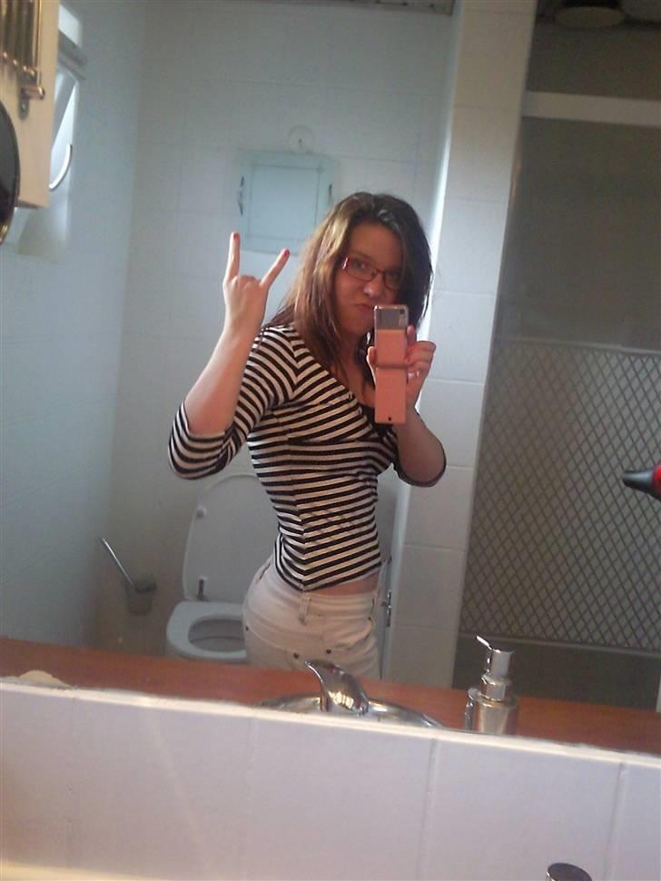 Morbus Scheuermann - min sygdom - Mit lændesvaj. billede 4