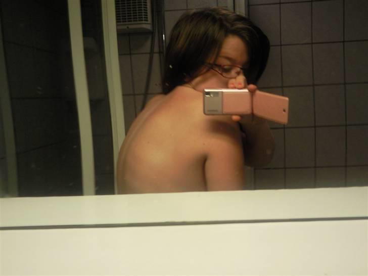 Morbus Scheuermann - min sygdom - Her kan I se min ryg uden tøj. Billedet er fra 7/8 - 09. billede 8