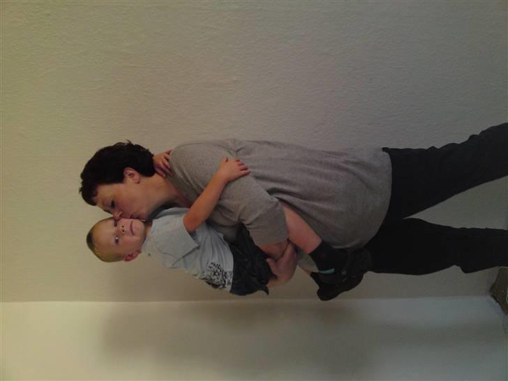 Før og efter (vægttab) - 75 kg billede 13