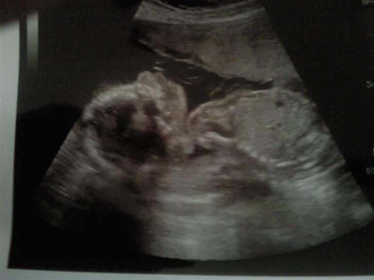 Min baby mave/Scanning´s billeder <3 billede 4