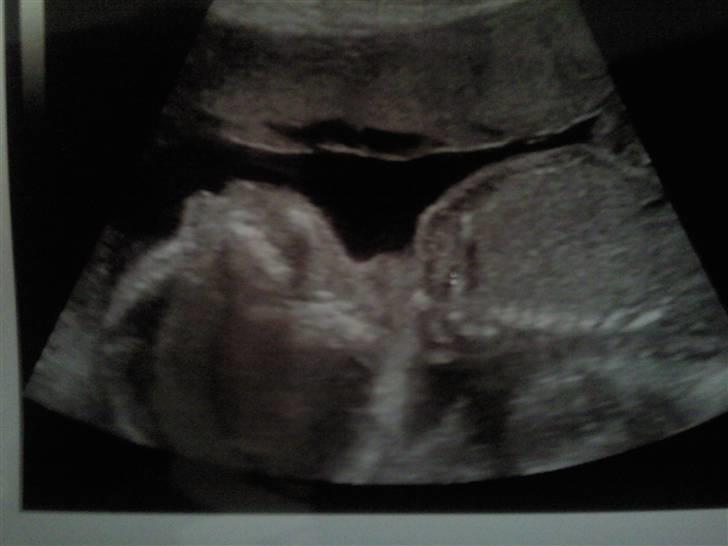 Min baby mave/Scanning´s billeder <3 billede 5