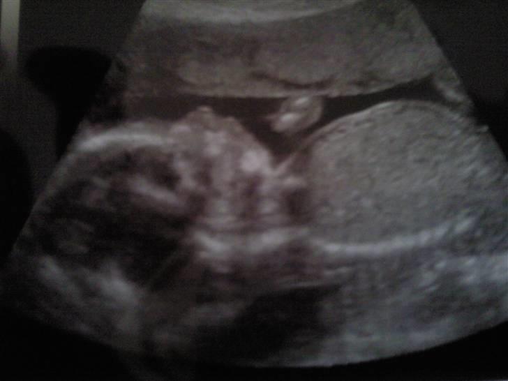 Min baby mave/Scanning´s billeder <3 billede 6