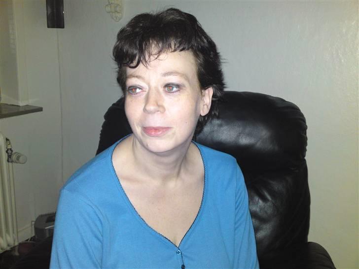 Før og efter (vægttab) - 75 kg billede 5