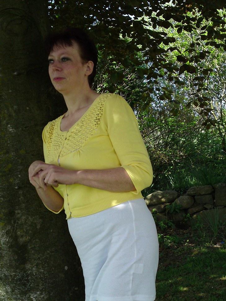 Før og efter (vægttab) - 75 kg billede 1