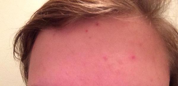 Mystiske knopper? (billeder af disse mystiske knopper er vedhæftet)