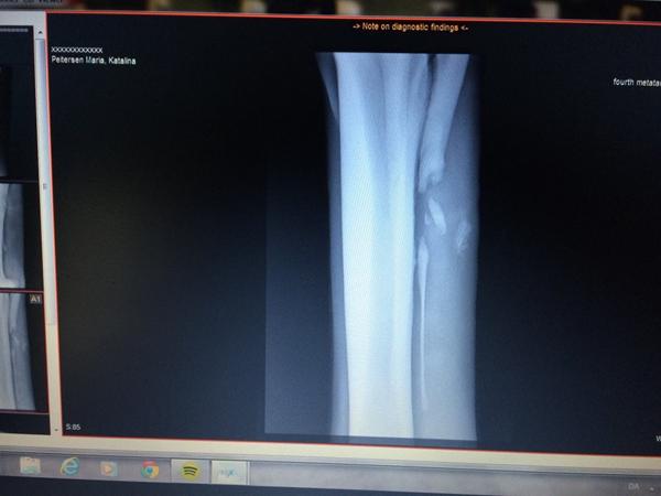 Genoptræning efter operation