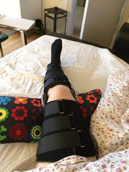 Knæ der er gået af led - erfaringer??