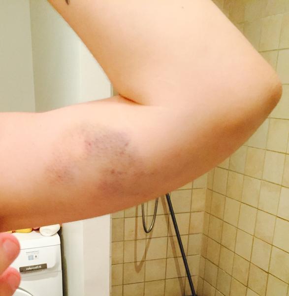 Hvorfor så,voldsom reaktion ?