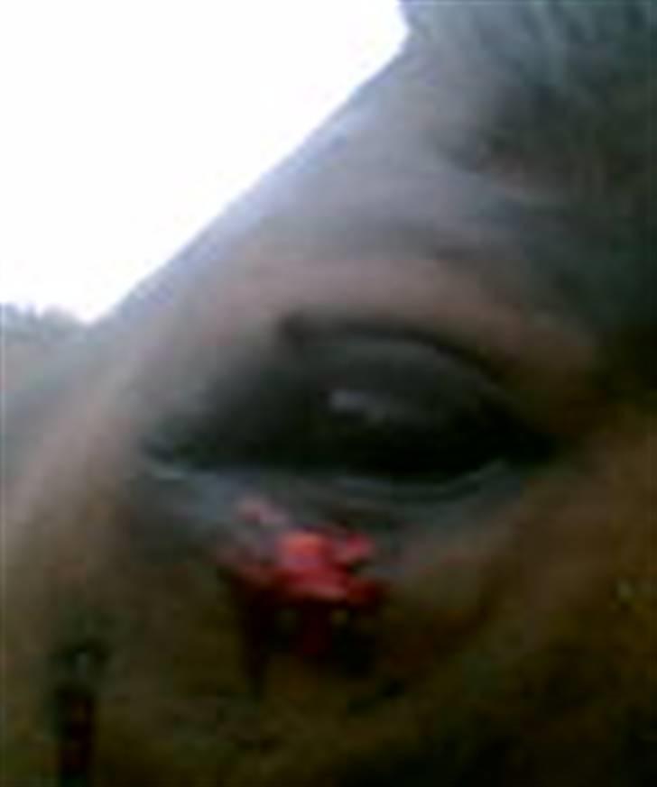 Dansk Varmblod Fair-Fight - fighters øje lige efter laika havde sparket på det!!! ikk så godt :( billede 9