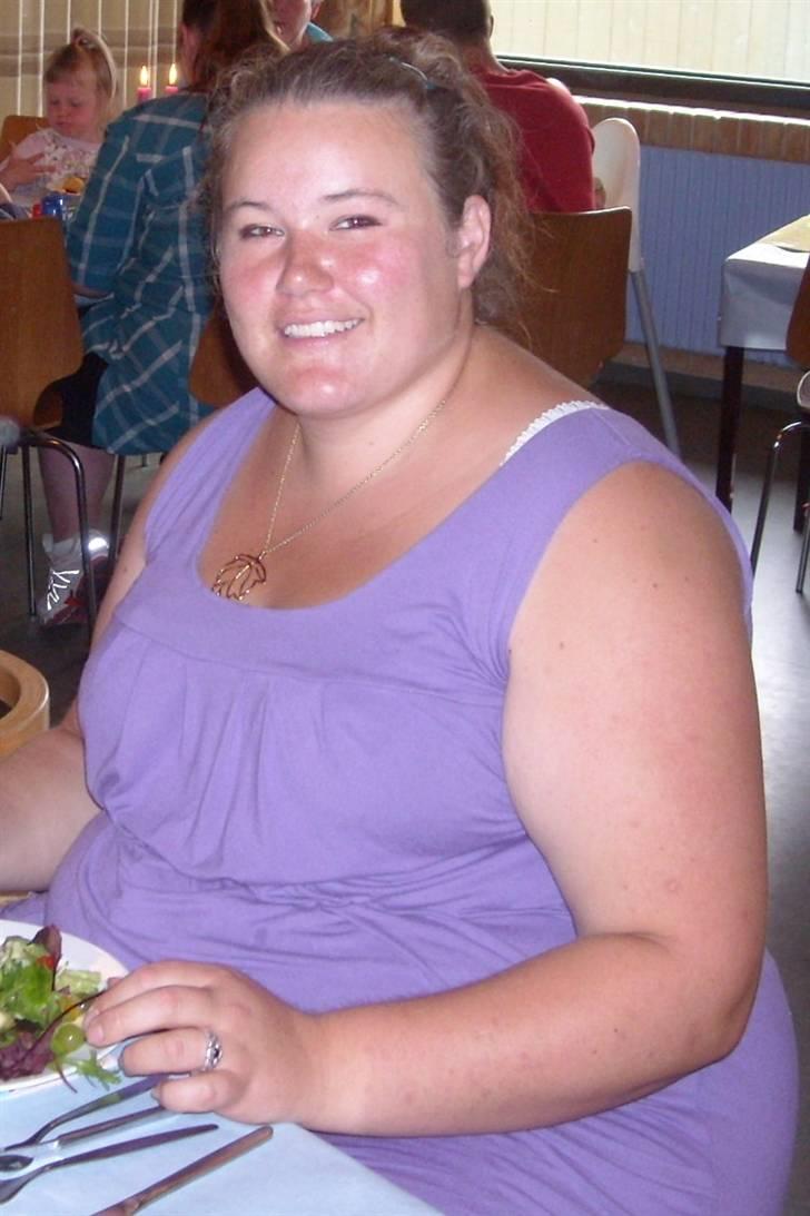 Mit Gastric Bypass forløb billede 2