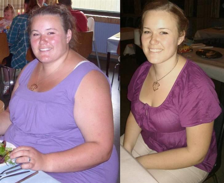 Mit Gastric Bypass forløb - 20. Marts

Tabt 47 kg billede 11