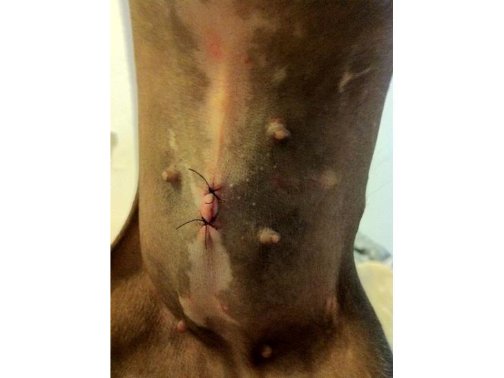 Laparoskopisk Sterilisation - Dagen efter operationen. billede 0
