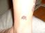 Mine tatovering