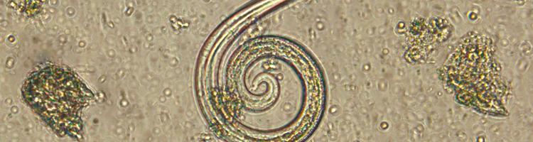 Fransk hjerteorm -en lumsk parasit