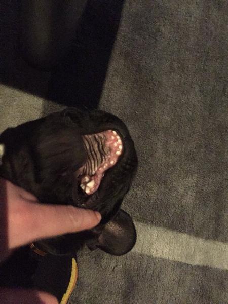 Er sådan et tandsæt normalt??