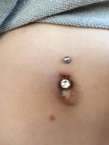 Piercing - betændelse