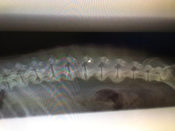 Spondylose - erfaringer?