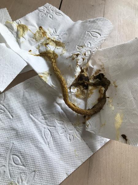 Advarsel: Billede af afføring, bekymret over afføring.