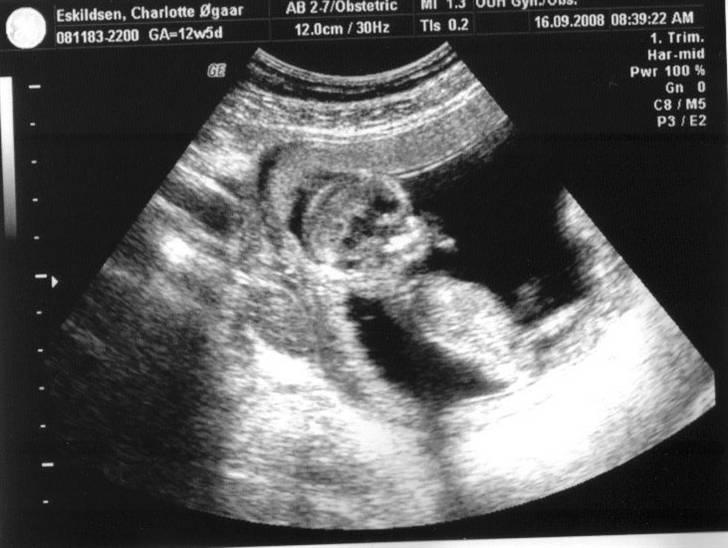 Beagle luna - 16/9-08 bebs er 13 uger og 4 dage gammel :-) billede 20