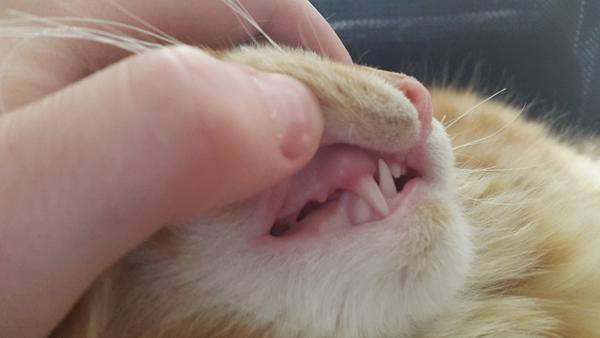 Tandkød, skal jeg være nervøs?