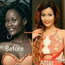 @pure%+27695222391 BUY TINAH BEST skin #lightening cream, Dark Spots/ Stretch Marks. pills, injection in Vereeniging, Orange Farm Johannesburg Lenasia Midrand Randburg Germiston Benoni 